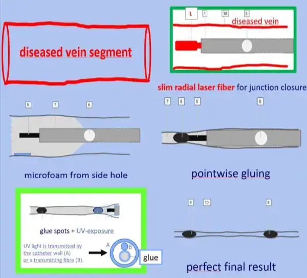 ScleroGlue-product-02